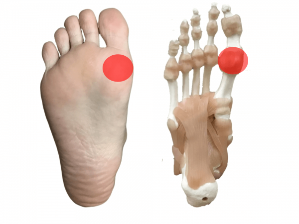 足 の 親指 の 付け根 が 痛い 対処 法